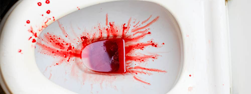Blood in Urine