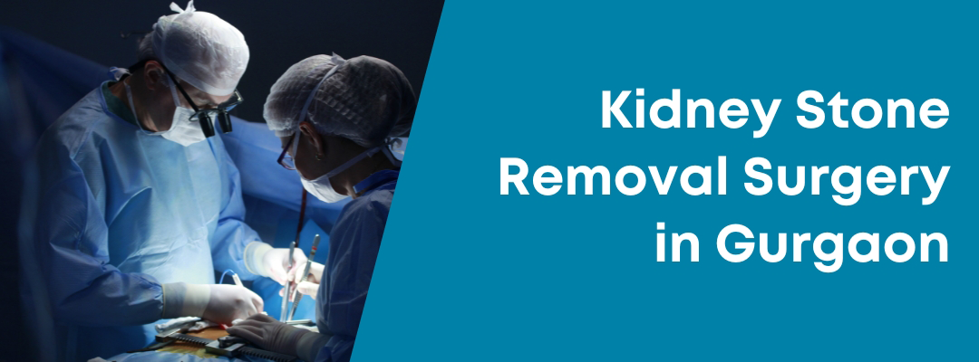 kidney stone removal surgery in Gurgaon