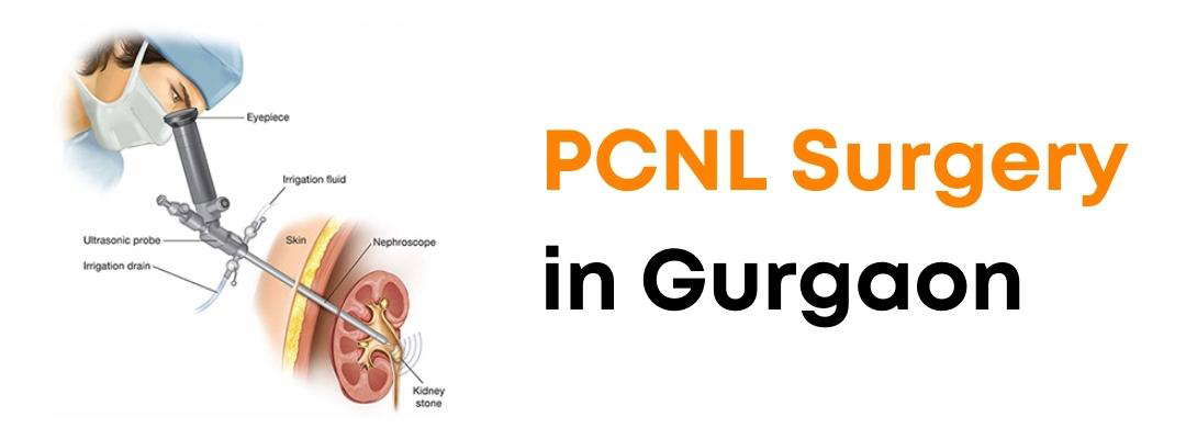 PCNL Surgery in Gurgaon